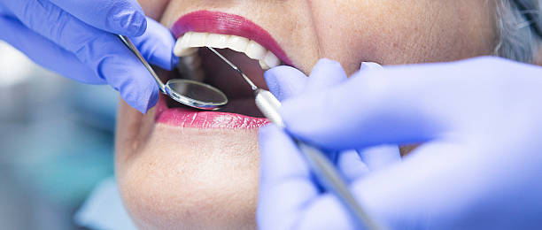 Best Emergency Dental Services for Seniors in Lamont, CA